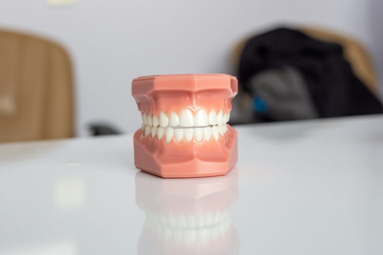 What Ugly Teeth You Have